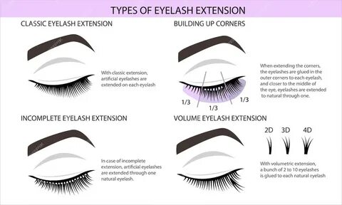 Extension type