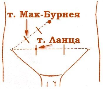 Маков точка