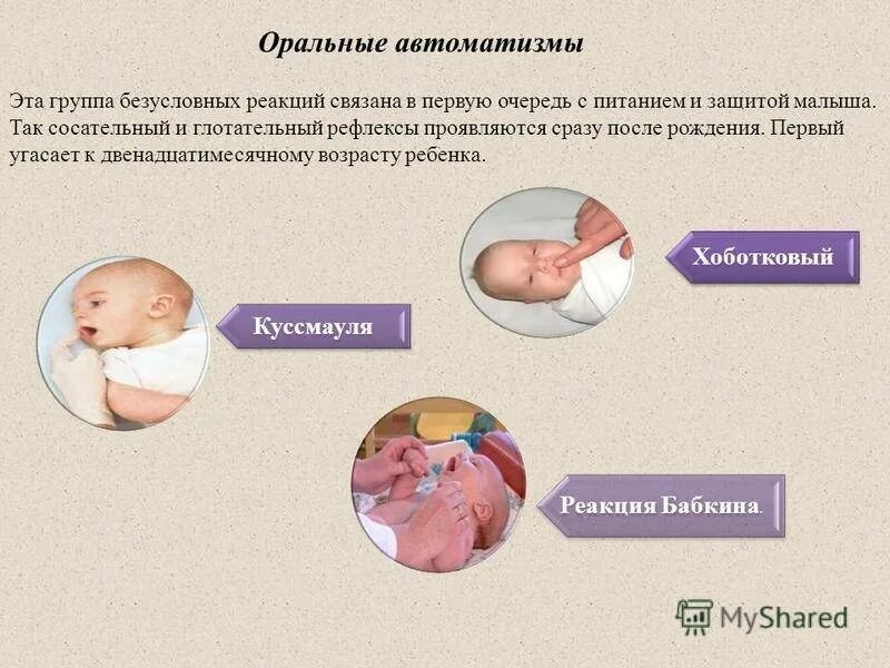 Рефлекс сосания. Рефлексы новорожденного ребенка. Рефлексы новорождённых и грудных детей. Врождённые физиологические рефлексы. Сосательный рефлекс новорожденного.