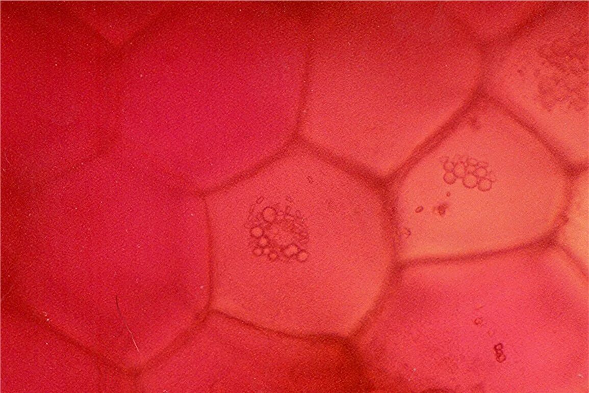 Клетки томата под микроскопом. Клетки мякоти томата под микроскопом. Клетки кожицы помидора под микроскопом. Клетки мякоти томата под лупой. Клетка мякоти рябины
