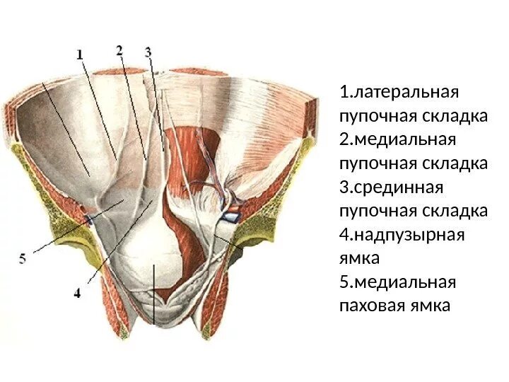 Срединная пупочная складка. Срединная пупочная связка мочевого пузыря. Латеральная пупочная ямка. Паховый канал латеральная и медиальная ямка.