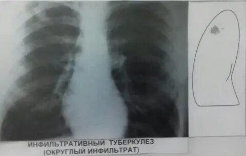 Шесть справа