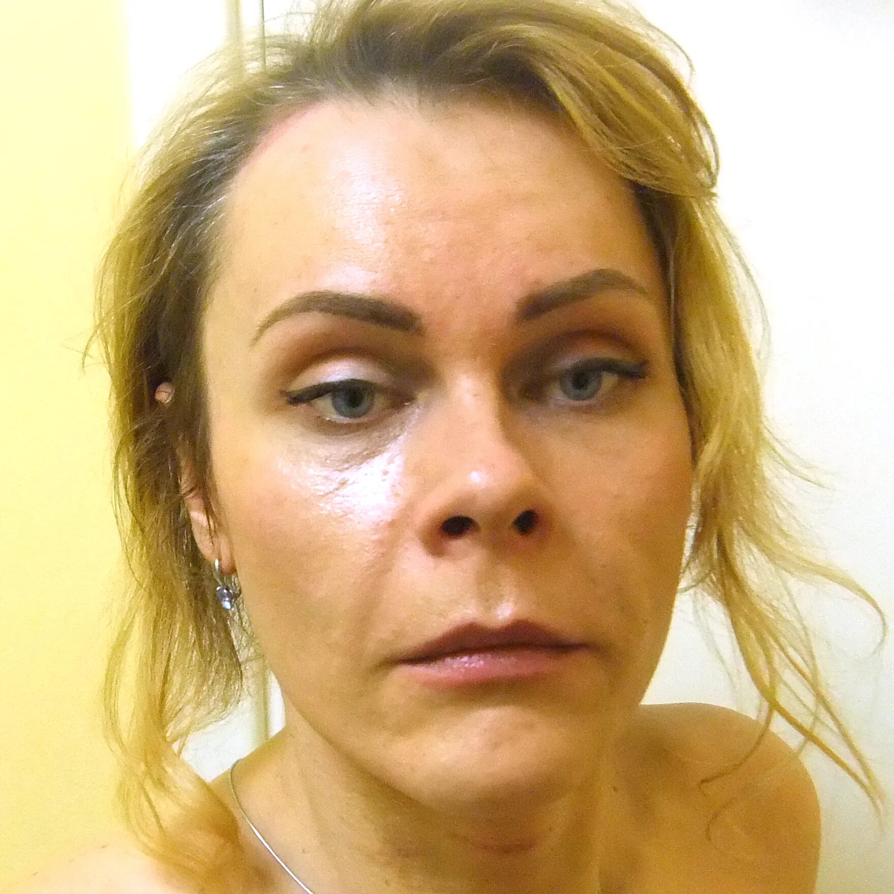 Феминизация before after. Феминизация лица. Феминизирующая пластика лица. Феминизация лица. Феминизация лица.