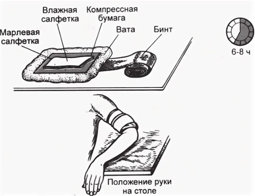 Согревающий компресс на ухо алгоритм. Обучите пациента правилам наложения согревающего компресса. методика наложения согревающего компресса. согревающий спиртовой компресс алгоритм. постановка согревающего компресса алгоритм.