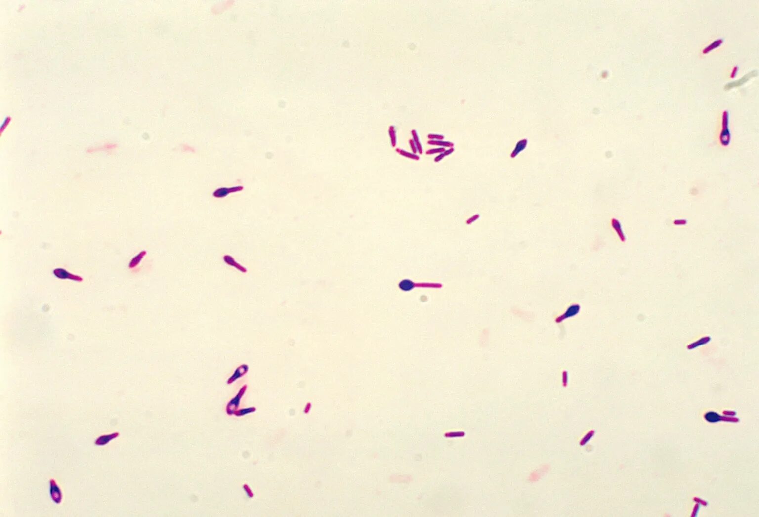 Клостридия ботулинум микроскопия. Клостридии ботулизма ( Clostridium botulinum ) ботулизм. Клостридиум ботулинум микроскопия. Клостридии ботулинум микроскопия.