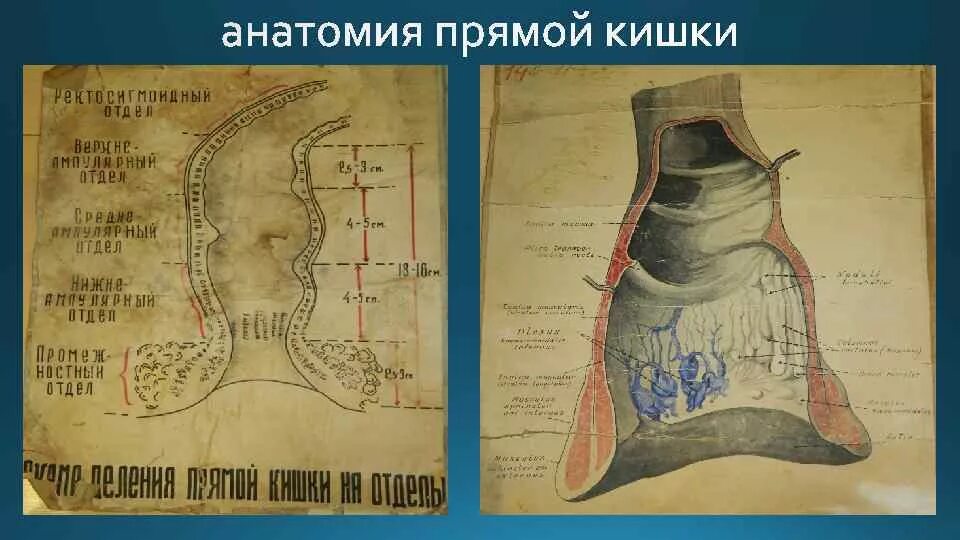 Прямой кишечник строение и функции. Прямая кишка новорожденного ребенка схема. Среднеампулярный отдел прямой кишки анатомия. Отделы и части прямой кишки. Строение кишечника толстая кишка.