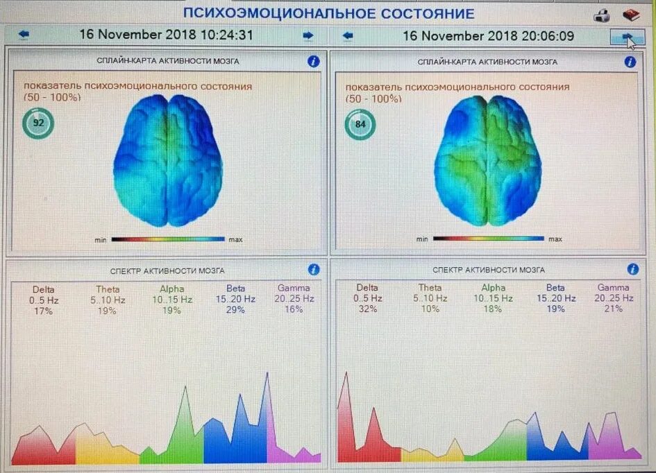 Спектр активности мозга. Частоты мозга. Альфа бета гамма волны. Гамма волны мозга.