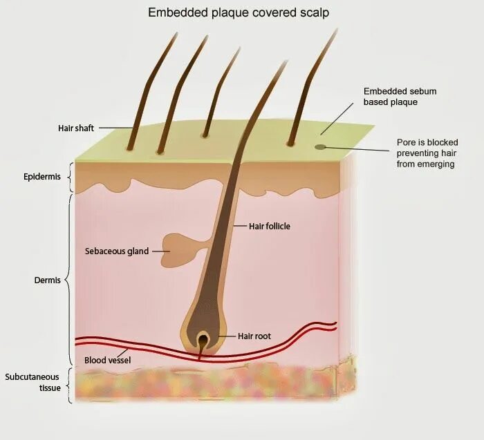 Волосы normal. Scalp перевод