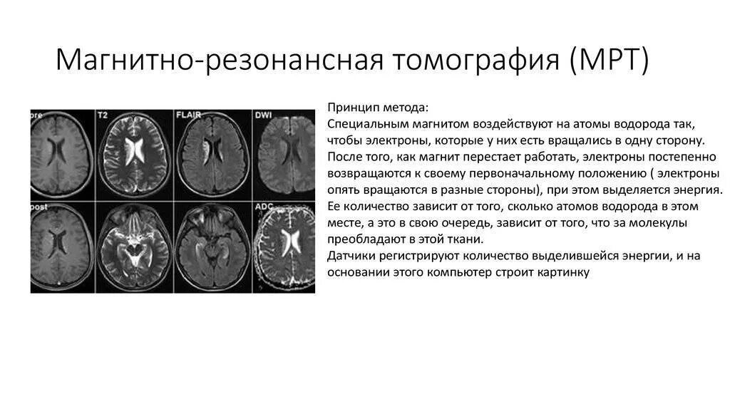 Мрт какие диагнозы. Физические принципы магнитно-резонансной томографии. Мрт сущность метода принцип получения изображения. Мрт физическая сущность ядерно-магнитного резонанса. Физический принцип мрт.