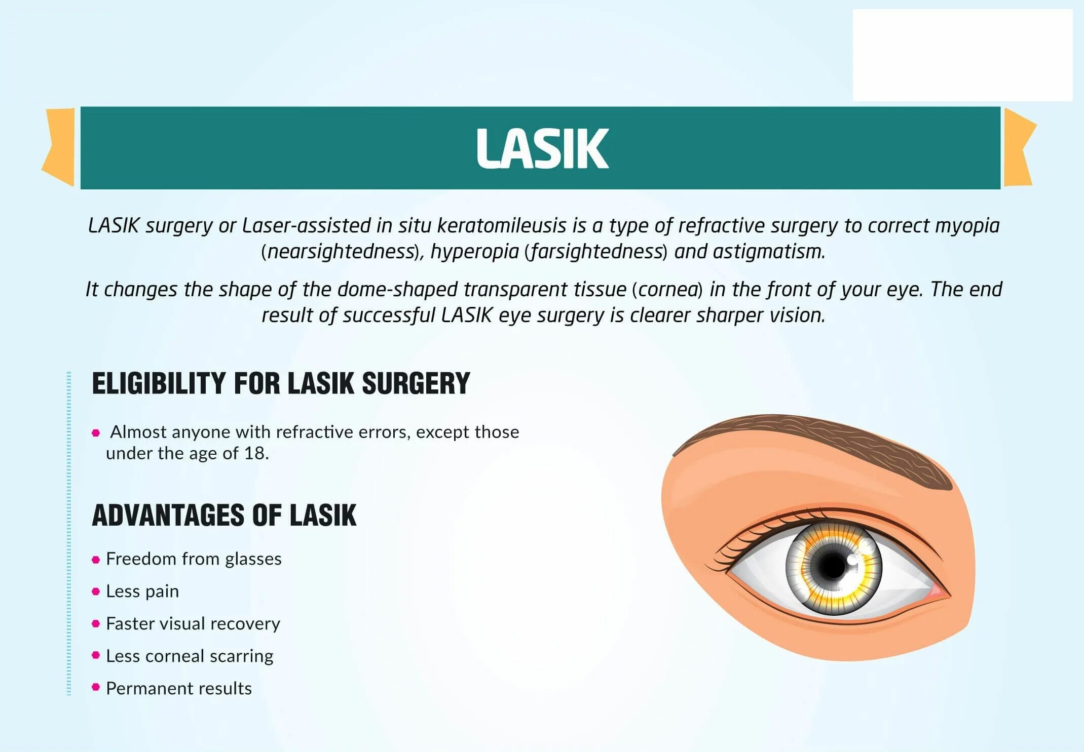 Операция ласик на глаза при астигматизме. LASIK лазерный кератомилез. Вернуть зрение операция