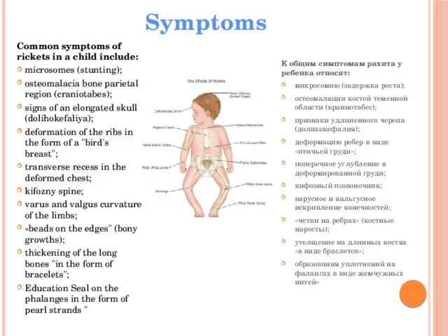 Рахит у детей грудничков симптомы. Симптомы рахита у детей 6 месяцев. Гипофосфатемический рахит у детей симптомы. Рахит в 6