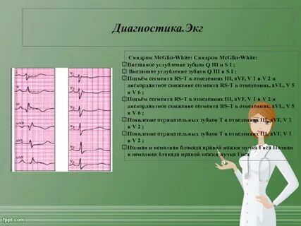Экг синдромы