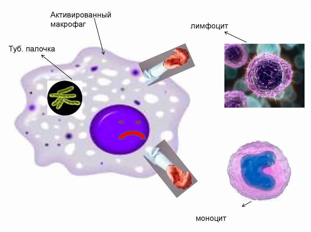 Макрофаги 1 2. Форма макрофагов. Макрофаги изображение. Макрофаг рисунок. Свободные и фиксированные макрофаги.