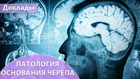 10 мозга