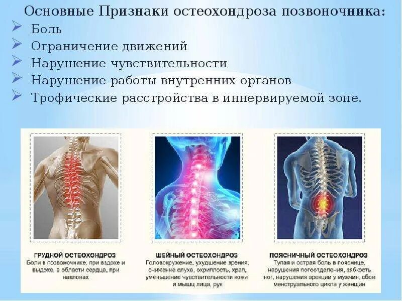 Боль в грудном отделе позвоночника. Клинические симптомы остеохондроза. Клинические проявления остеохондроза грудного отдела. Остеохондроз позвоночника симптомы. Проявления поясничного остеохондроза.