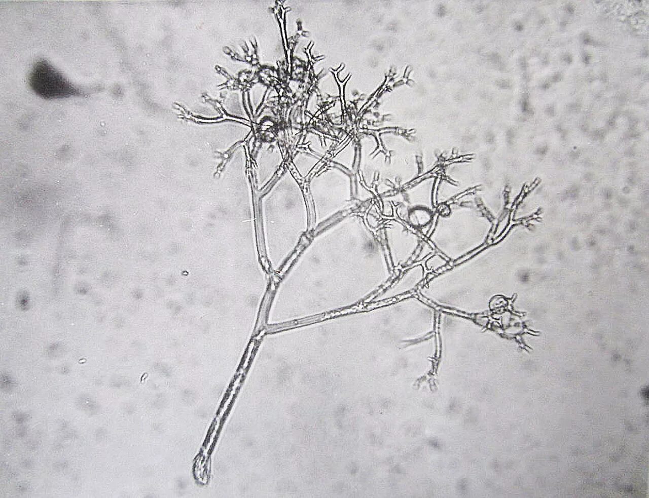 Конидии peronospora. Peronospora hyoscyami. Peronospora tabacina. Конидии фитофторы. Мицелий грибов на коже