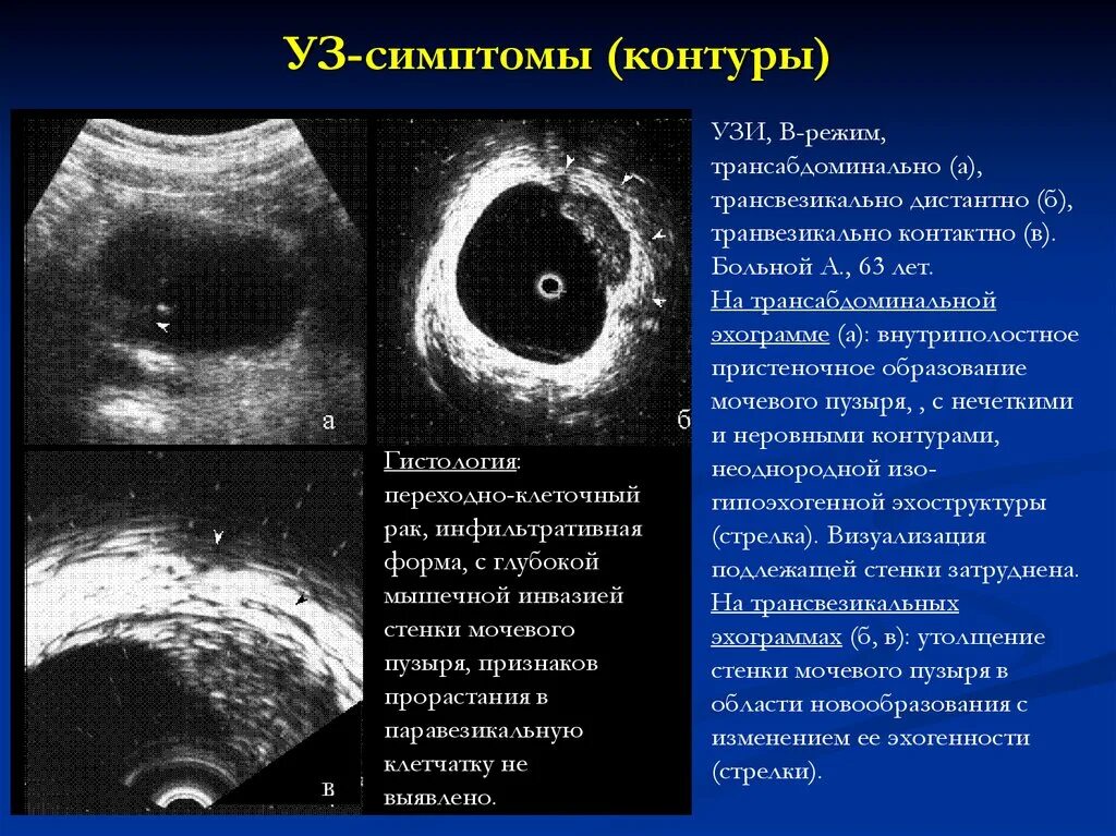 Неоднородное округлое образование