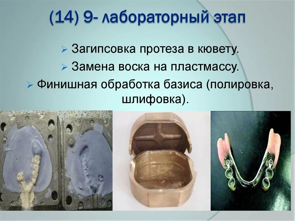Моделировка штампованных коронок резец. Коронка цельнолитая кхс. Коронки цельнолитой (из сплава кхс). Клинико лабораторные этапы изготовления бюгельных протезов. 1 лабораторный этап изготовления штампованных коронок.
