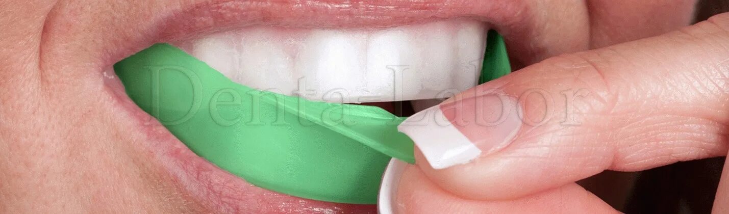 Капа как использовать. Капа для отбеливания зубов стоматологическая. Капа для отбеливания зубов (на 2 челюсти). Реминерализация каппы. Капы для отбеливания.