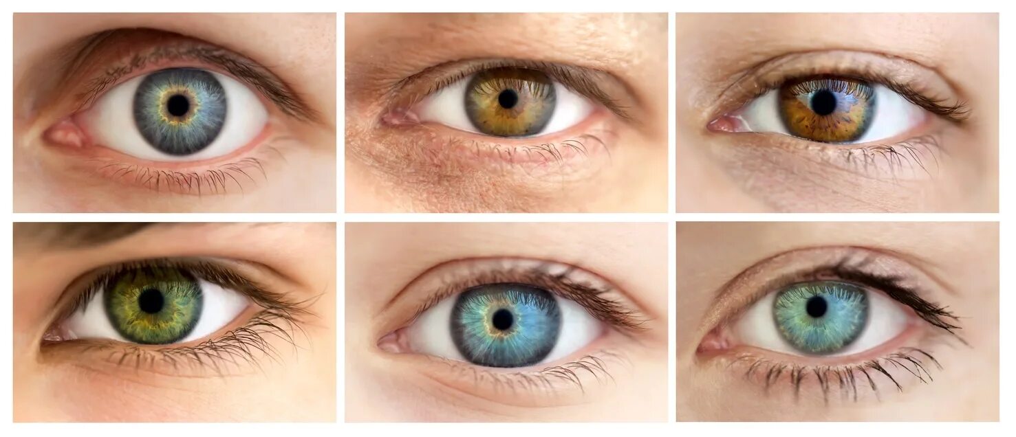 Цвет глаз. Карие глаза с голубым оттенком. Цвета глаз у человека. Изменение карего цвета глаз.