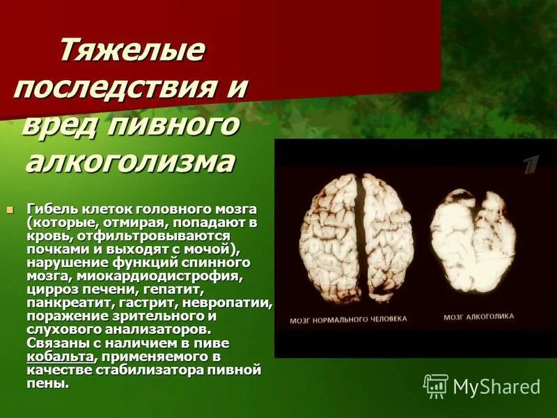 Последствия алкоголизма мозг. Последствия пивного алкоголизма. Отмирание клеток головного мозга.