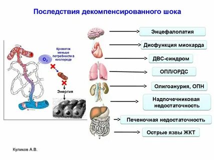 Последствия потрясения
