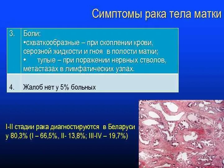 Развитие рака матки. Признаки онкологии матки. Наиболее частые опухоли тела матки:. Карцинома шейки матки жалобы.