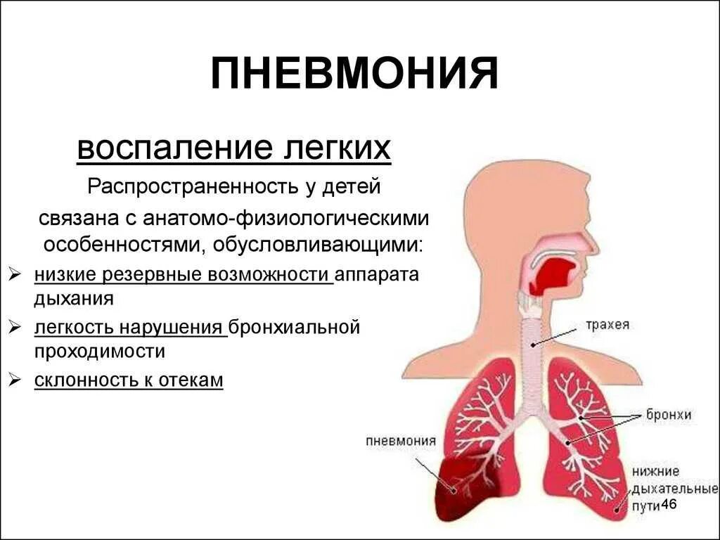 Инфекция легких лечение. Легочные проявления пневмонии.