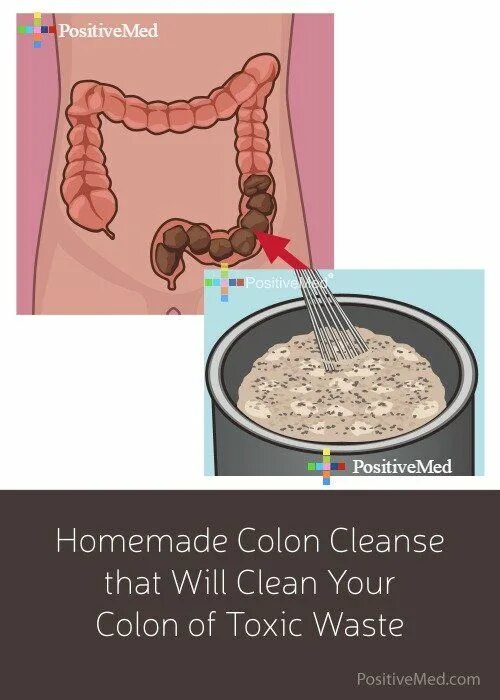 Как очистить кишечник от газов. Змея после чистки кишечника. Colon Cleansing Machine. Где в кишечнике селятся глисты.