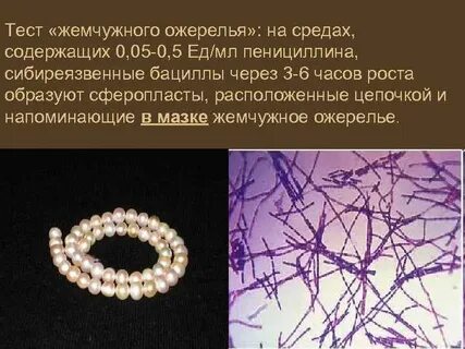 Реакция на сибирскую язву
