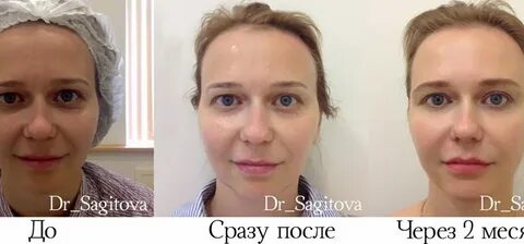 Смас глаза отзывы