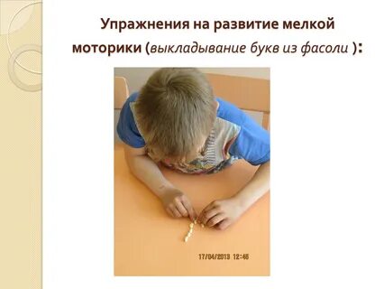Особенности моторики зпр