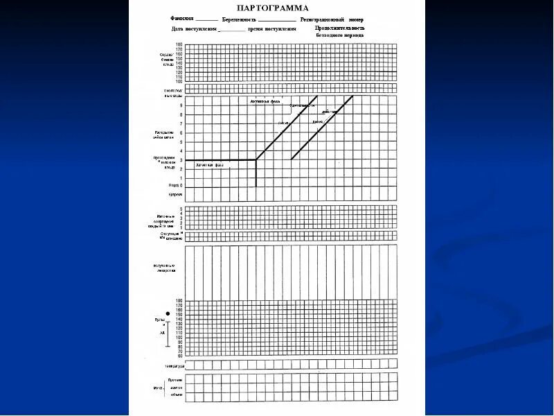Партограмма. Партограмма. Цель партограмма. Партограмма в акушерстве. Партограмма нормальные роды.