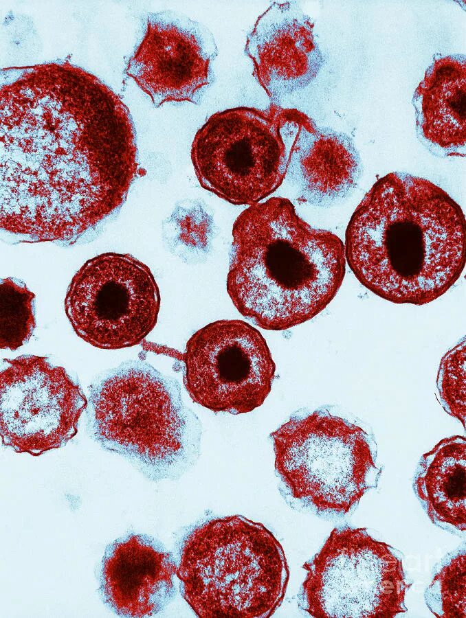 Chlamydia trachomatis. Хламидия трахоматис под микроскопом.