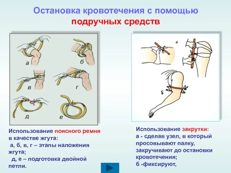 В качестве импровизированного жгута можно использовать