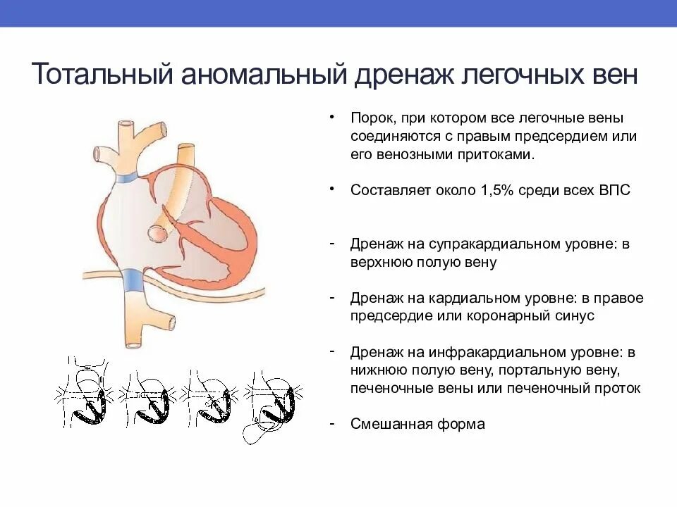 Впс коннект