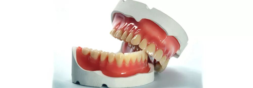 13 на протезирование. 13 на протезирование. имплантация зубов по технологии «all on 4». стоматологические коронки. имплантологическая кассета nobel полный набор для all on 4.