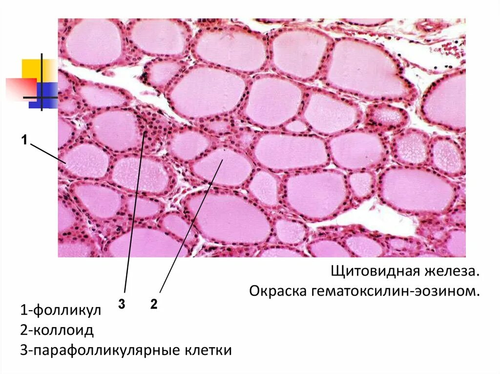 Парафолликулярные клетки щитовидной железы. Щитовидная железа гистология препарат. Щитовидная железа микропрепарат гистология. Срез щитовидной железы гистология.
