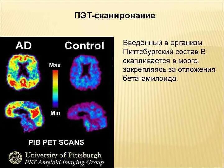 Пэт сканирование. Пэт сканирование