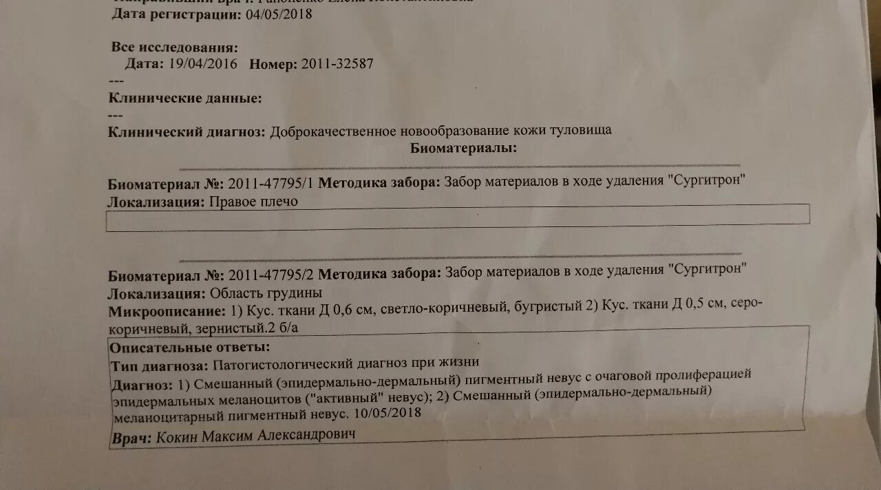 Гистология родинки заключение. Результат гистологии родинки. Гистологическое заключение при биопсии. Заключения биопсии родинки.