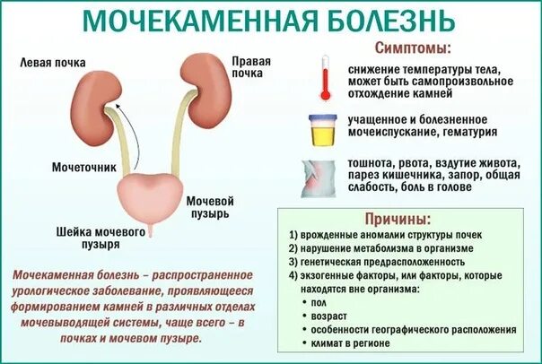 Мочевой пузырь печень. Заболевания мочевыделительной системы мочекаменная болезнь. Клинические симптомы мочекаменной болезни. Заболевание почек мочекаменная болезнь симптомы. Мочекаменная болезнь причины.