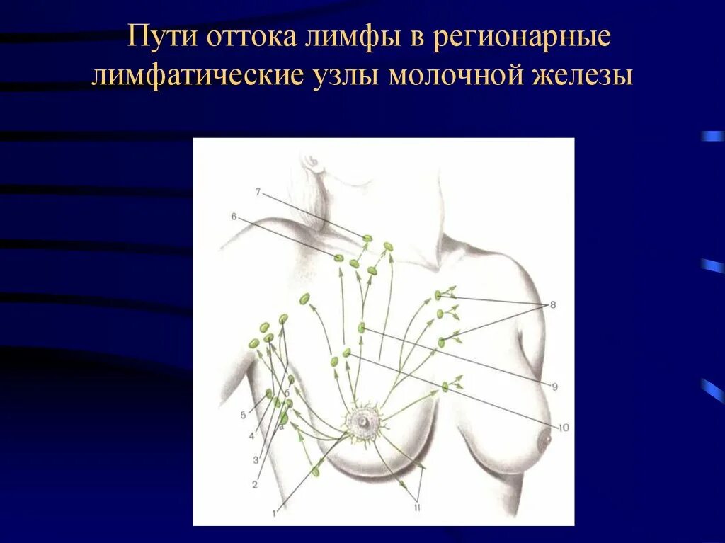 Лимфатические узлы молочной железы и лимфоотток. Регионарные лимфоузлы молочных желез. Регионарные лимфатические узлы схема. Регионарные подключичные лимфоузлы. Лимфоузлы при рмж