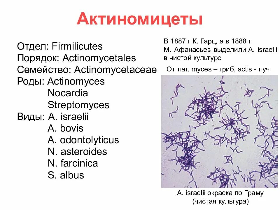 Инфекция латынь. Актиномицеты строение микробиология. Возбудитель актиномикоза микробиология. Актиномицеты микробиология окраска. Актиномицеты микробиология морфология.