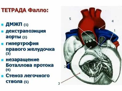 Впс 10