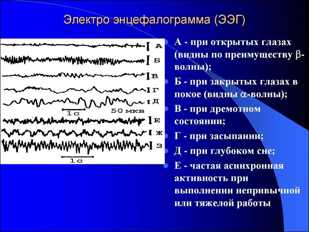 Ээг с функциональными пробами. Ээг патология. ээг волны. порядок проведения ээг. патологические ритмы ээг.