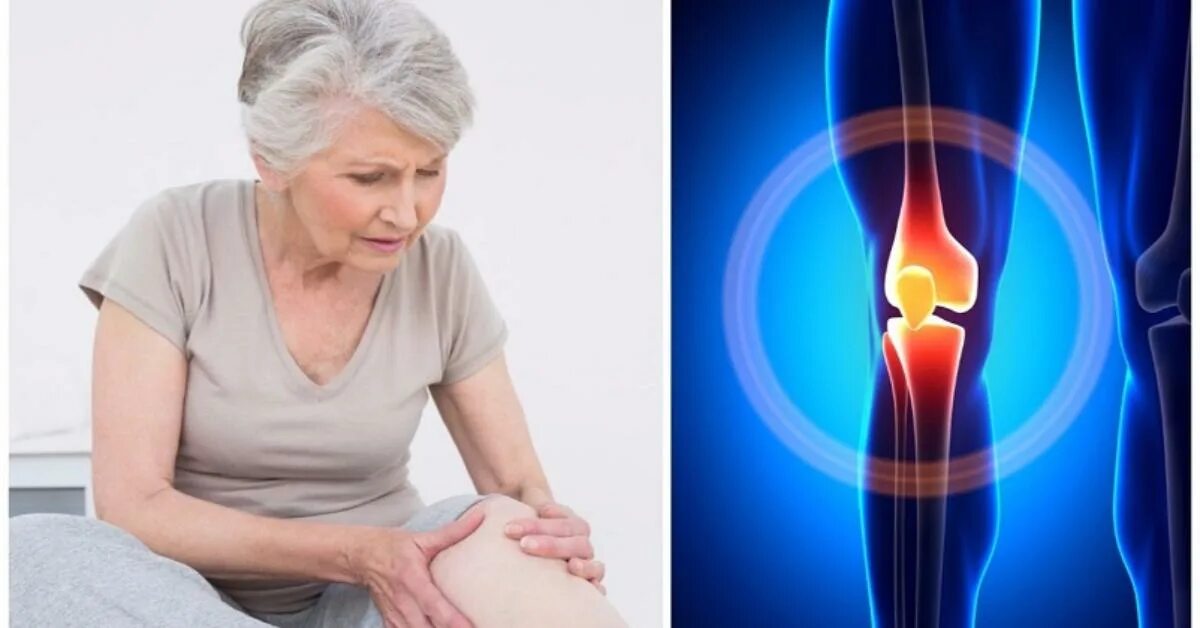 суставы болят причины у женщин после 50
