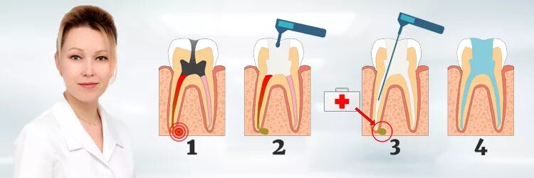 Антибиотик при воспалении корня зуба. Воспаление корня зуба антибиотик.