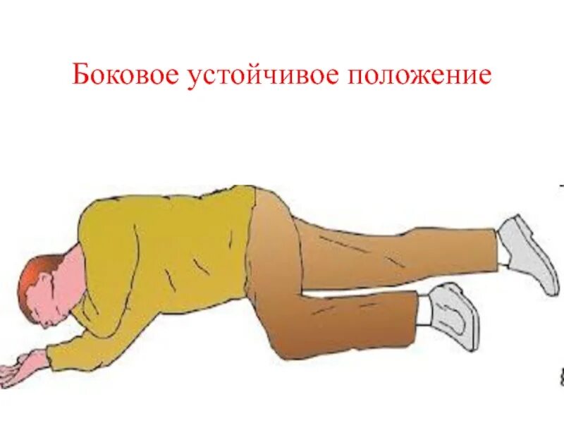 Слр устойчивое боковое положение. Как придать устойчивое боковое положение. Этапы придания пострадавшему устойчивого бокового положения. Придание устойчивого бокового положения пострадавшему. Устойчивое боковое положение пострадавшего.
