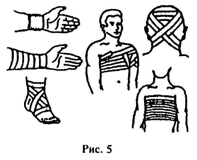 Техника наложения различных повязок. Циркуляторная повязка десмургия. Технология наложения круговой повязки. Спиральная повязка. Спиральная и циркулярная повязка.