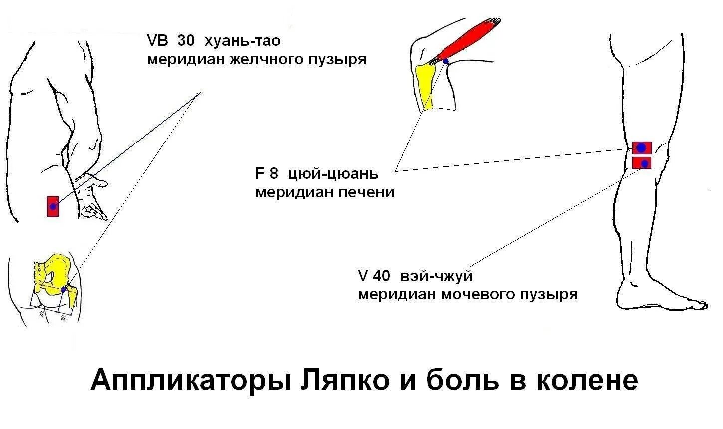 После бега болят колени что делать. Болит коленка при сгибании сбоку. Болит сбоку коленного сустава.